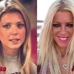 Tara Reid Before and After Cosmetic Surgery 150x150