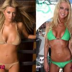 Tara Reid Plastic Surgery Before and After 150x150