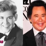 Wayne Newton Before and After Facelift 150x150