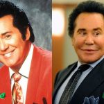 Wayne Newton Plastic Surgery Before and After 150x150