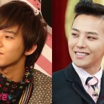 G Dragon Before and After Cosmetic Surgery 150x150
