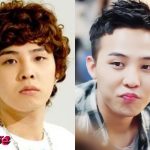 G Dragon Before and After Surgery Transformation 150x150