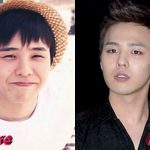 G Dragon Plastic Surgery Before and After 150x150
