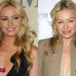 Portia De Rossi Before and After Cosmetic Surgery 150x150