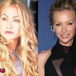 Portia De Rossi Before and After Surgery Procedure 150x150