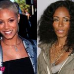 Jada Pinkett Smith Before and After Cosmetic Surgery 150x150