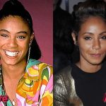 Jada Pinkett Smith Before and After Surgery Procedure
