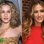 Sarah Jessica Parker Before and After Cosmetic Surgery 150x150