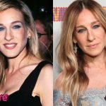 Sarah Jessica Parker Before and After Surgery Procedure 150x150