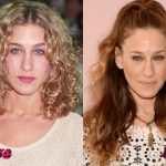 Sarah Jessica Parker Plastic Surgery Before and After 150x150