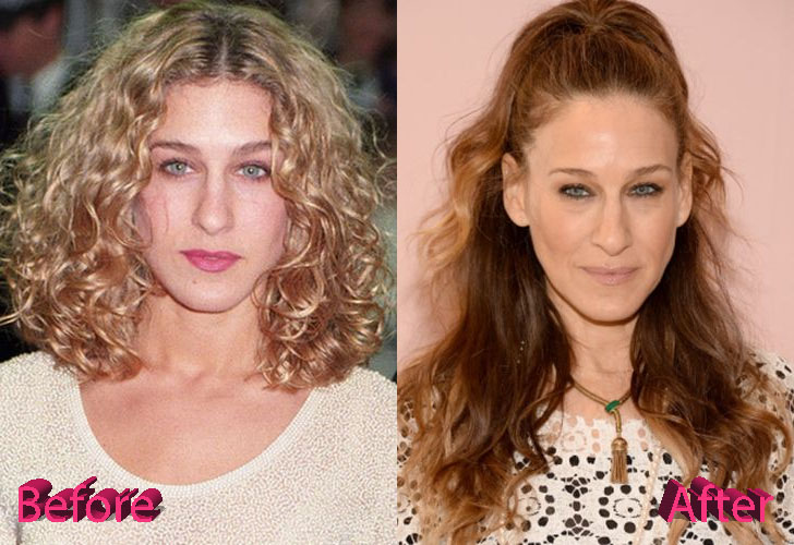 Sarah Jessica Parker Plastic Surgery Before and After