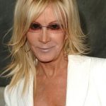 Joan Van Ark After Plastic Surgery