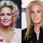 Joan Van Ark Plastic Surgery Before and After 150x150