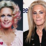 Joan Van Ark Plastic Surgery Before and After
