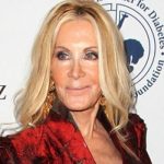 Joan Van Ark Plastic Surgery Controversy