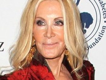 Joan Van Ark Plastic Surgery: When Everything Goes Wrong