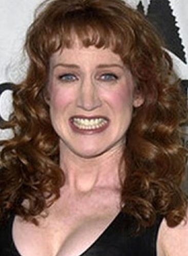 Kathy Griffin Before Cosmetic Surgery
