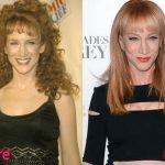 Kathy Griffin Plastic Surgery Before and After 150x150