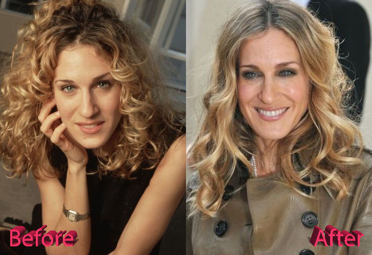 Sarah Jessica Parker Before and After Nose Job Surgery