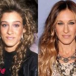 Sarah Jessica Parker Before and After Rhinoplasty Procedure