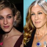 Sarah Jessica Parker Nose Job Before and After