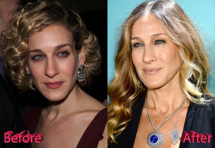 Sarah Jessica Parker Nose Job Before and After.