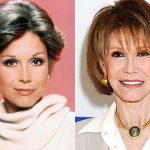 Mary Tyler Moore Before and After Cosmetic Surgery 150x150