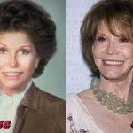 Mary Tyler Moore Plastic Surgery Before and After 150x150