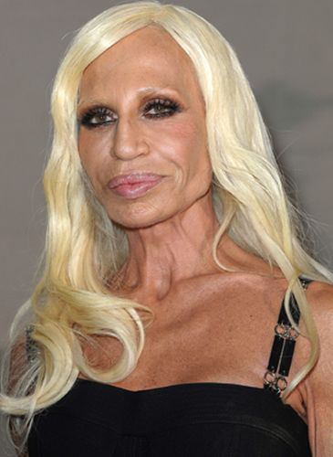 Donatella Versace After Multiple Surgeries