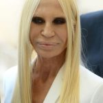 Donatella Versace After Plastic Surgery 150x150
