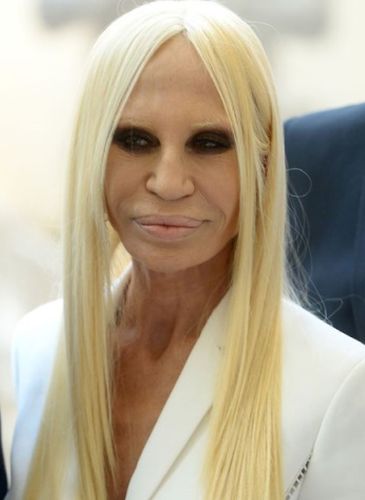 Donatella Versace After Plastic Surgery
