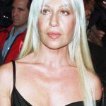 Donatella Versace Before Plastic Surgery 150x150