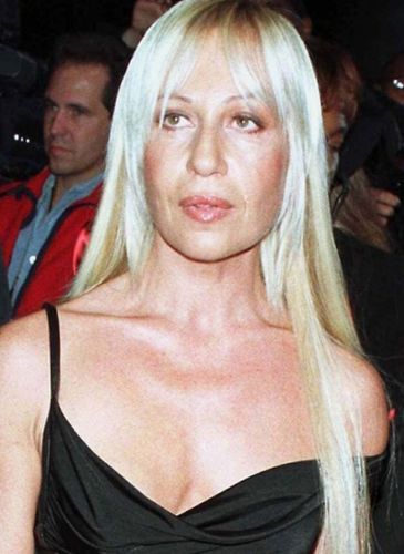 Donatella Versace Before Plastic Surgery