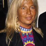 Donatella Versace Before Surgery Procedures 150x150