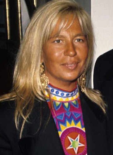 Donatella Versace Before Surgery Procedures