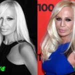 Donatella Versace Before and After Cosmetic Surgery 150x150