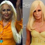 Donatella Versace Before and After Multiple Surgeries 150x150