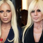 Donatella Versace Before and After Plastic Surgery 150x150