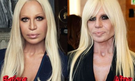 Donatella Versace Plastic Surgery: Not Fashionable At All