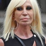 Donatella Versace Plastic Surgery Fail 150x150