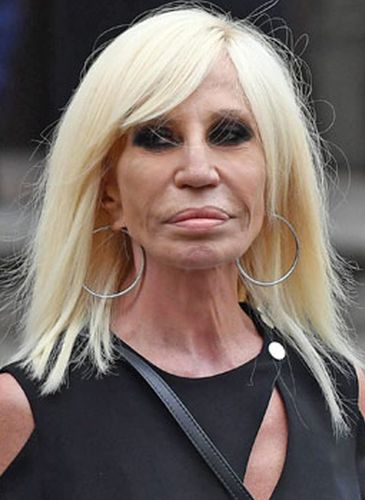 Donatella Versace Plastic Surgery Fail