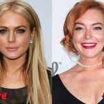 Lindsay Lohan Before and After Cosmetic Surgery 150x150