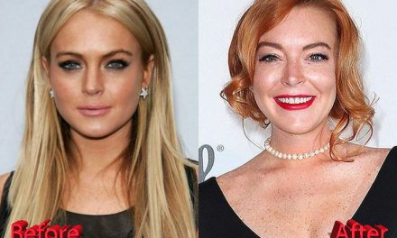 Lindsay Lohan Plastic Surgery : Is She Done With It?