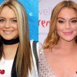 Lindsay Lohan Before and After Plastic Surgery 150x150