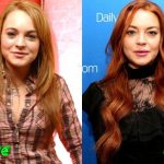 Lindsay Lohan Before and After Surgery Procedure 150x150
