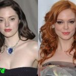 Rose McGowan Before and After Cosmetic Surgery 150x150