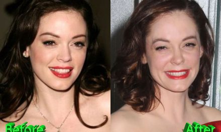 Rose Mcgowan Plastic Surgery: You Be the Judge