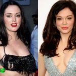 Rose McGowan Before and After Plastic Surgery 150x150