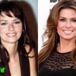 Shania Twain Before and After Cosmetic Surgery 150x150