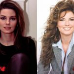 Shania Twain Before and After Plastic Surgery 150x150